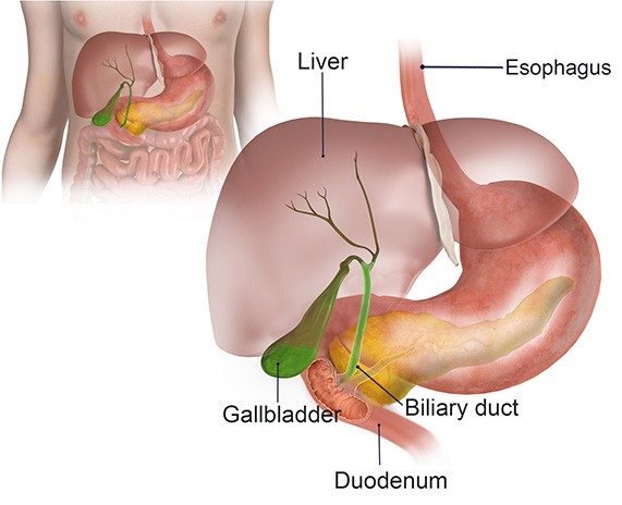 Bile Duct Surgery Melbourne Laparoscopic Bile Duct Surgery Melbourne